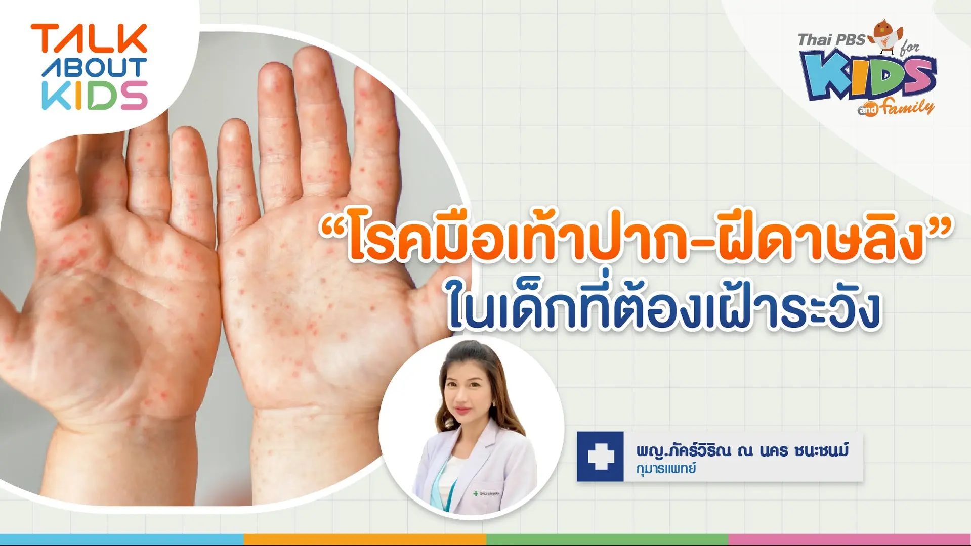 "โรคมือเท้าปาก-ฝีดาษลิง" ในเด็กที่ต้องระวัง