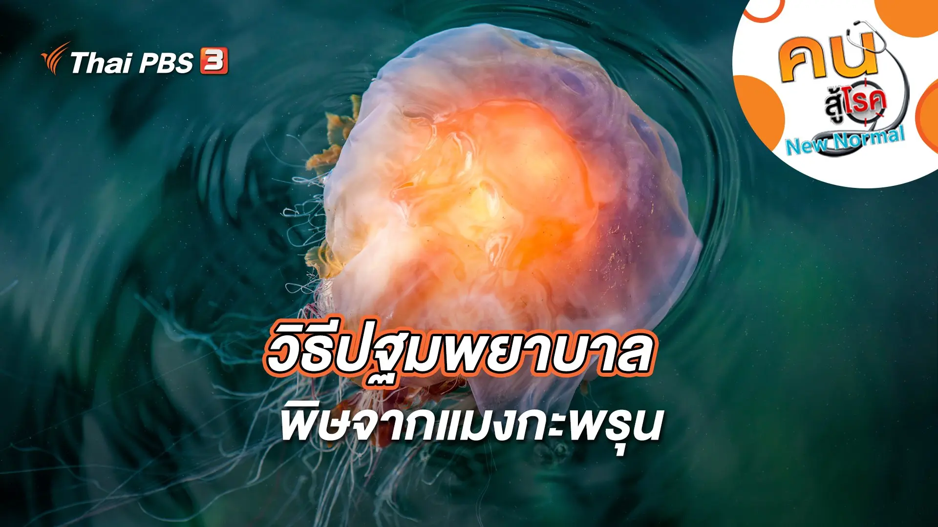 วิธีปฐมพยาบาลพิษจากแมงกะพรุน