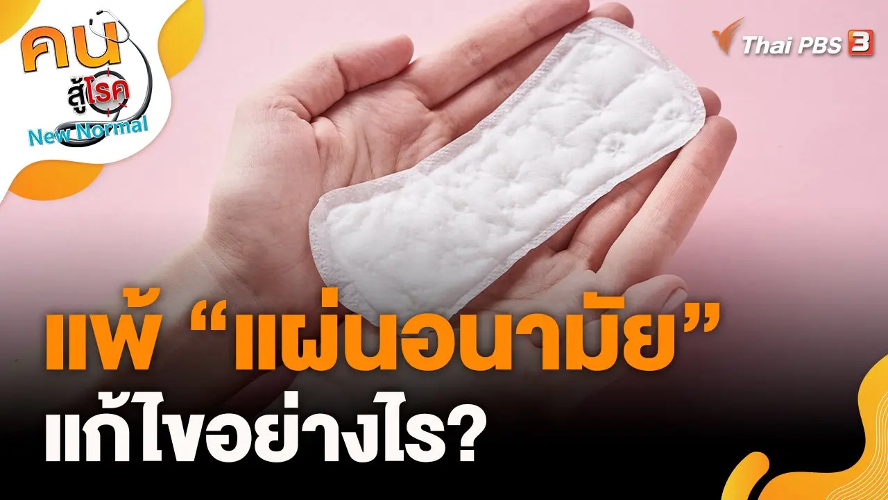 แพ้แผ่นอนามัย สามารถแก้ไขได้อย่างไร