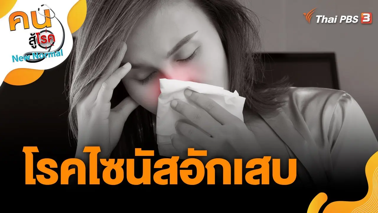 โรคไซนัสอักเสบ