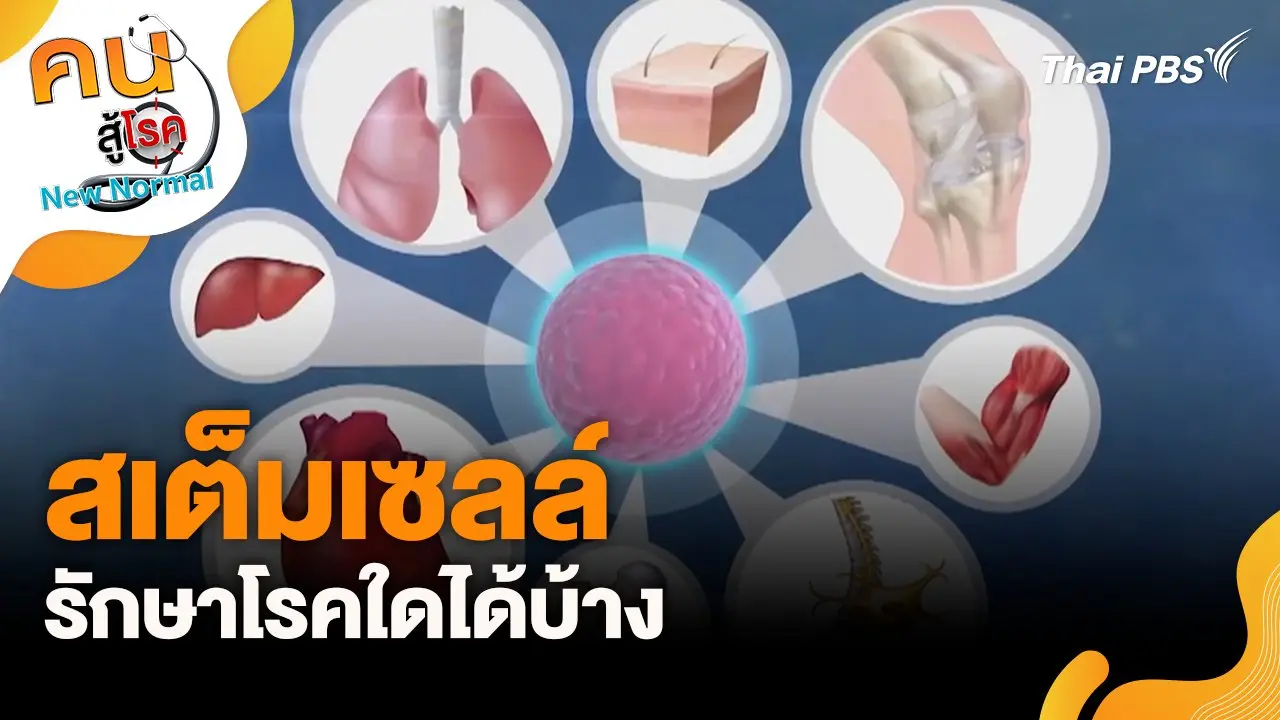 สเต็มเซลล์ รักษาโรคใดได้บ้าง