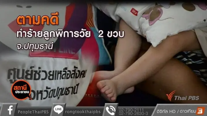 ​ตามคดีพ่อทำร้ายลูกพิการ วัย 2 ขวบ