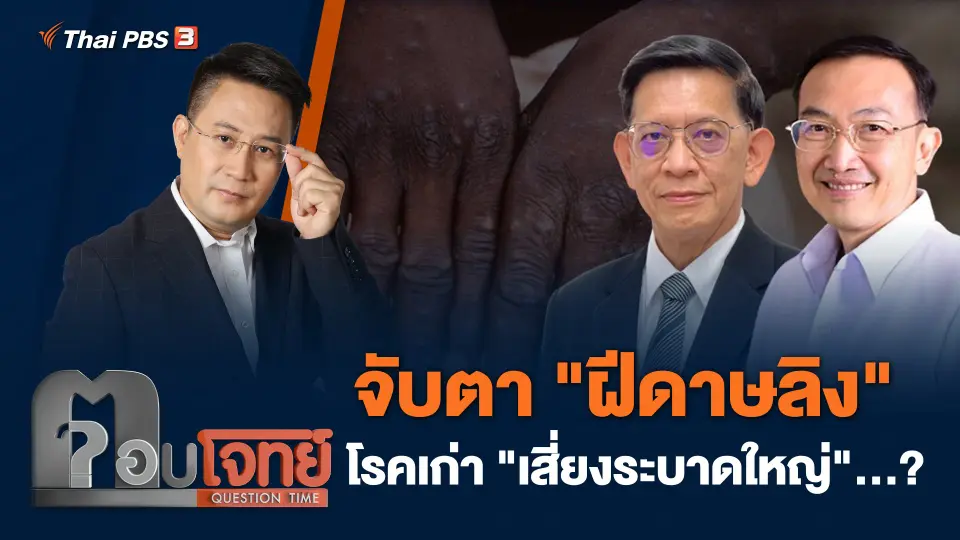 จับตา "ฝีดาษลิง" โรคเก่า "เสี่ยงระบาดใหญ่"...?