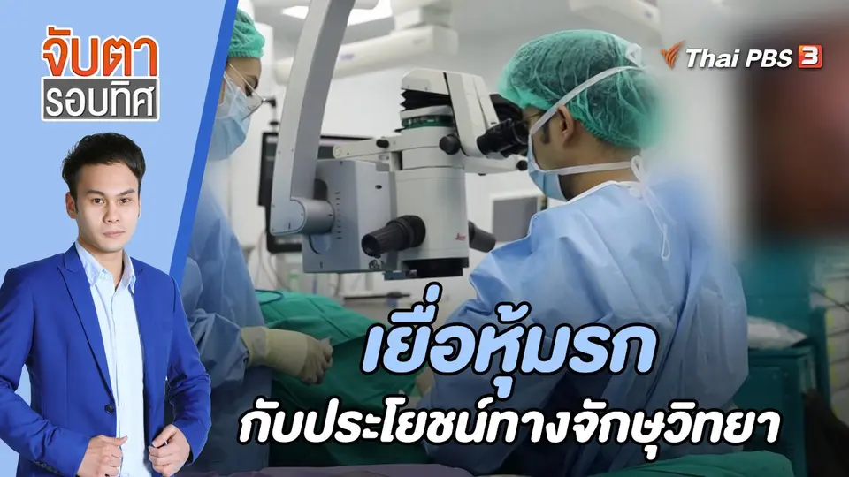 จับตารอบทิศ