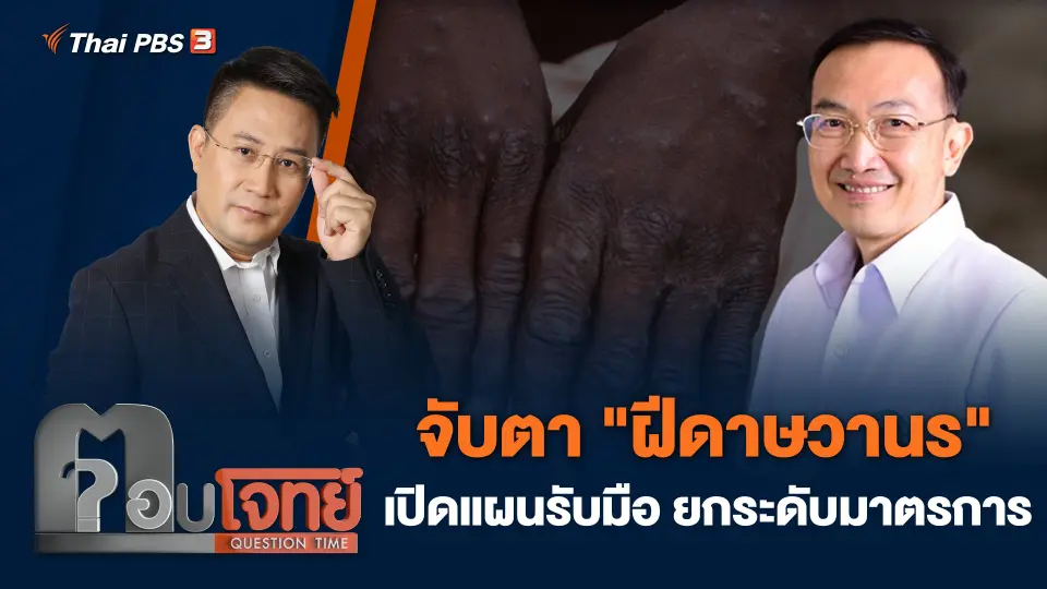 จับตา "ฝีดาษวานร" เปิดแผนรับมือ ยกระดับมาตรการ