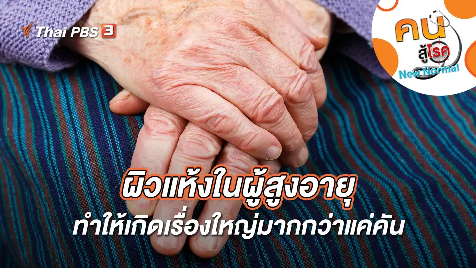 ผิวแห้งในผู้สูงอายุ ทำให้เกิดเรื่องใหญ่มากกว่าแค่คัน