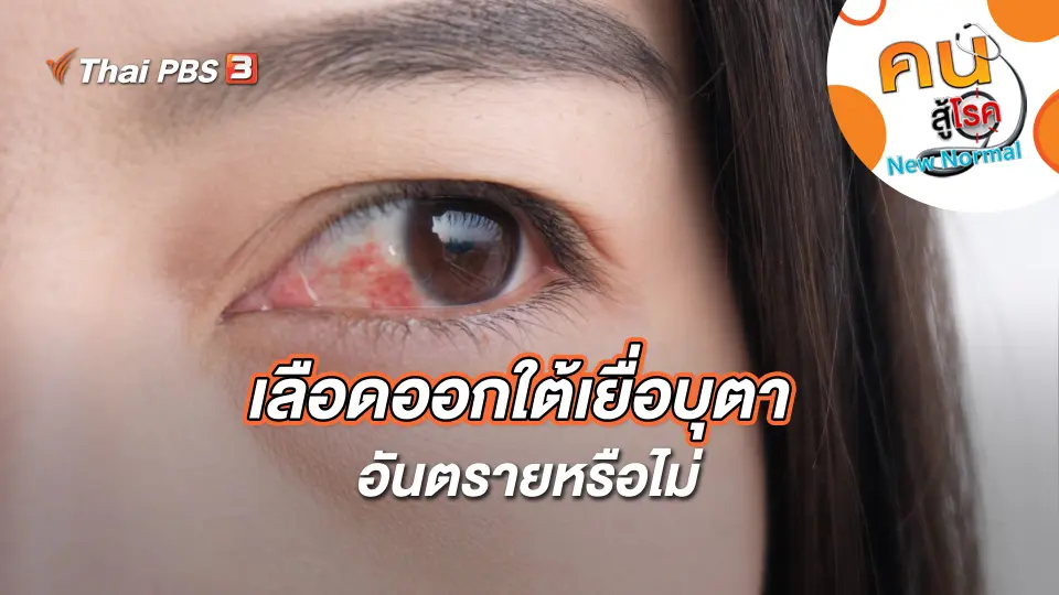 คนสู้โรค