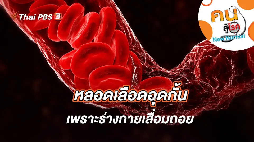 คนสู้โรค