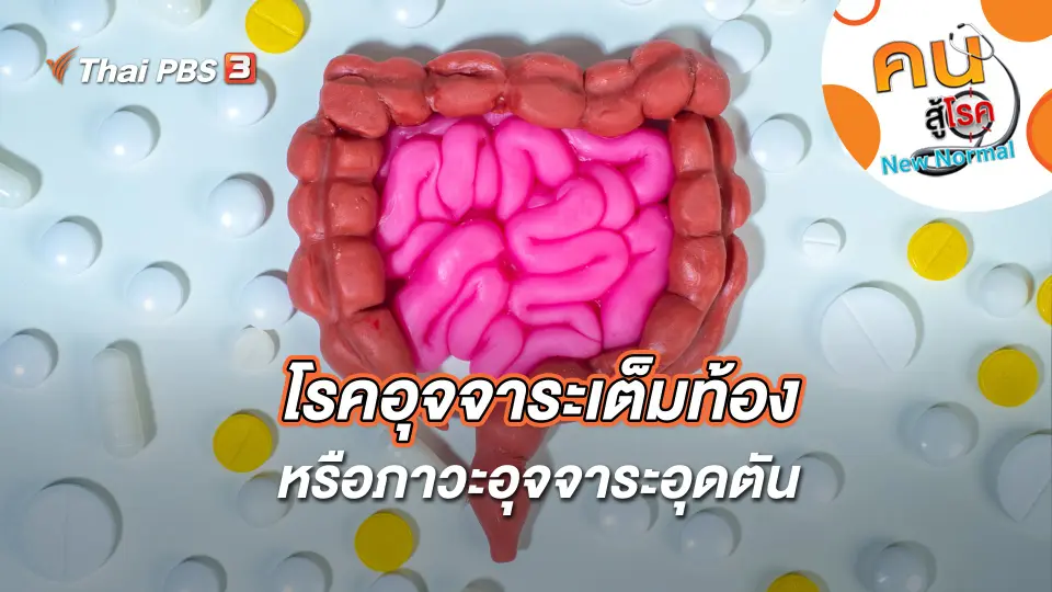 โรคอุจจาระเต็มท้อง หรือภาวะอุจจาระอุดตัน