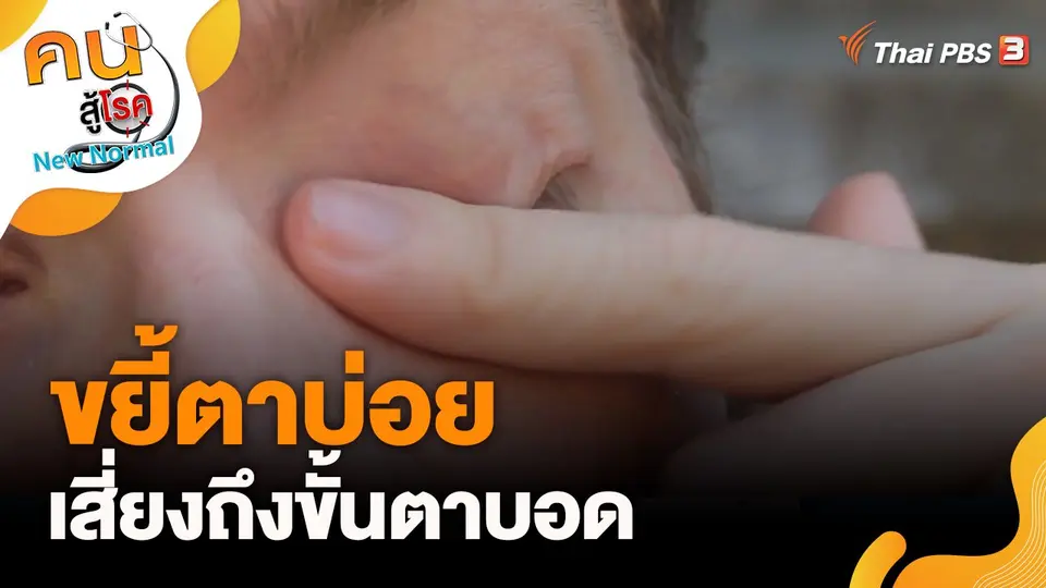 ขยี้ตาบ่อยเสี่ยงถึงขั้นตาบอด