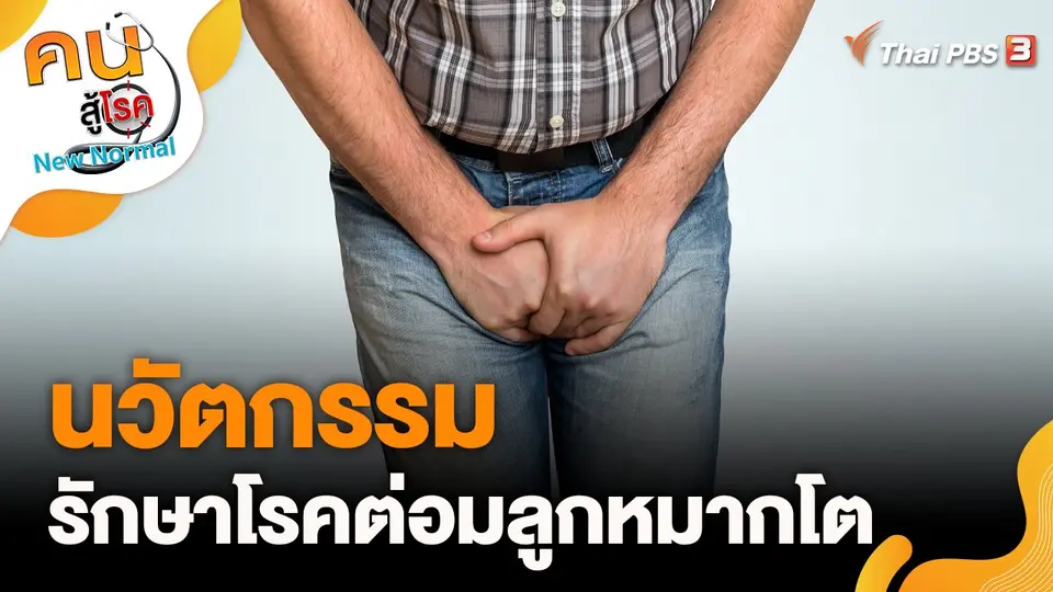 นวัตกรรมในการรักษาโรคต่อมลูกหมากโต