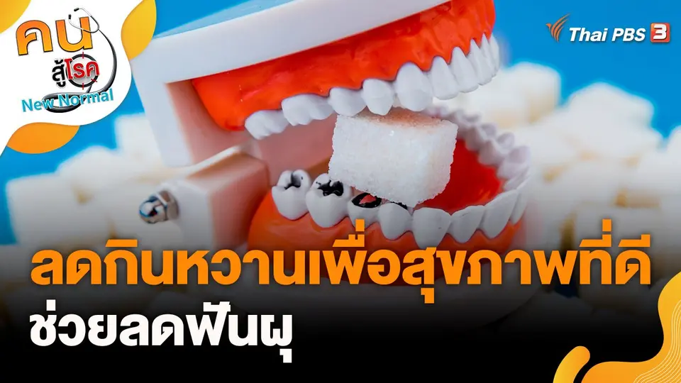ลดกินหวานเพื่อสุขภาพที่ดี ช่วยลดฟันผุ