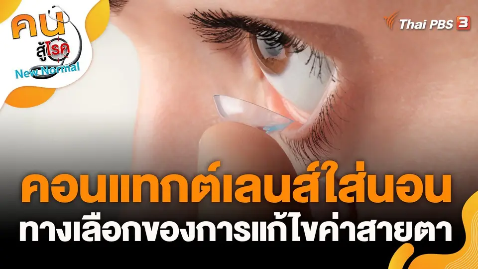คอนแทกต์เลนส์ใส่นอน ทางเลือกของการแก้ไขค่าสายตา