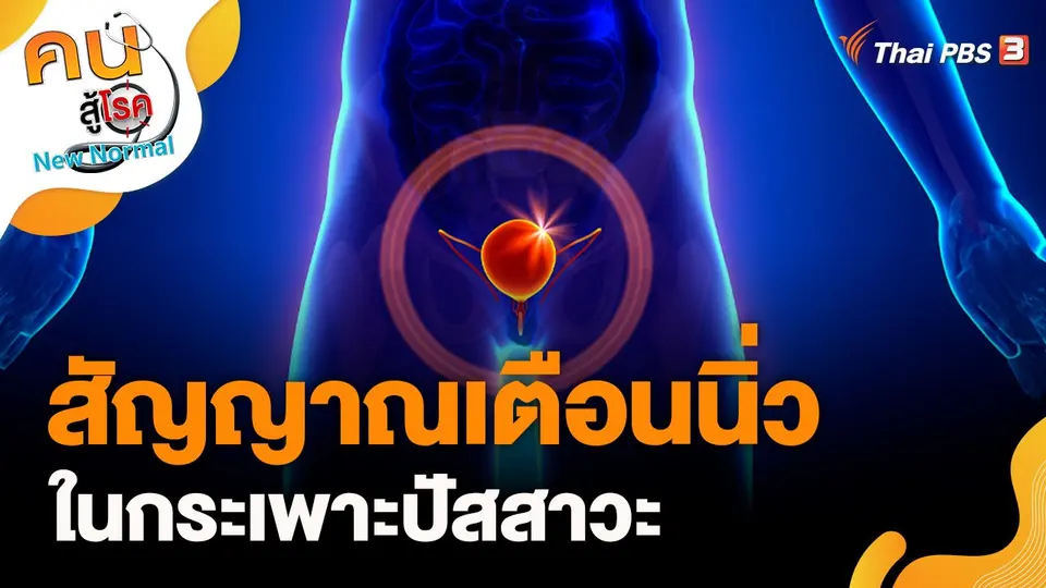 สัญญาณเตือนนิ่วในกระเพาะปัสสาวะ