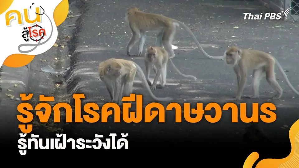 รู้จักโรคฝีดาษวานร