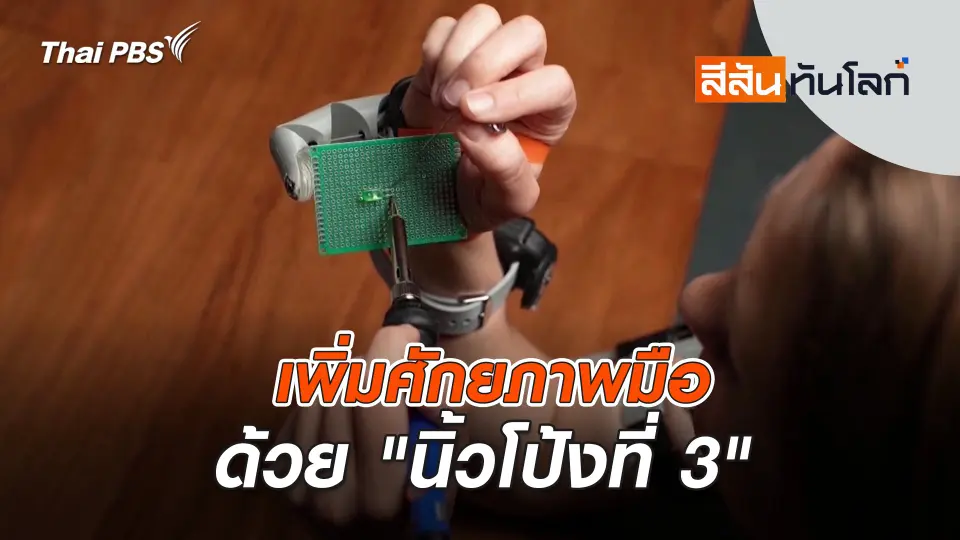 เพิ่มศักยภาพมือด้วย "นิ้วโป้งที่ 3" | สีสันทันโลก | 6 ก.ค. 67
