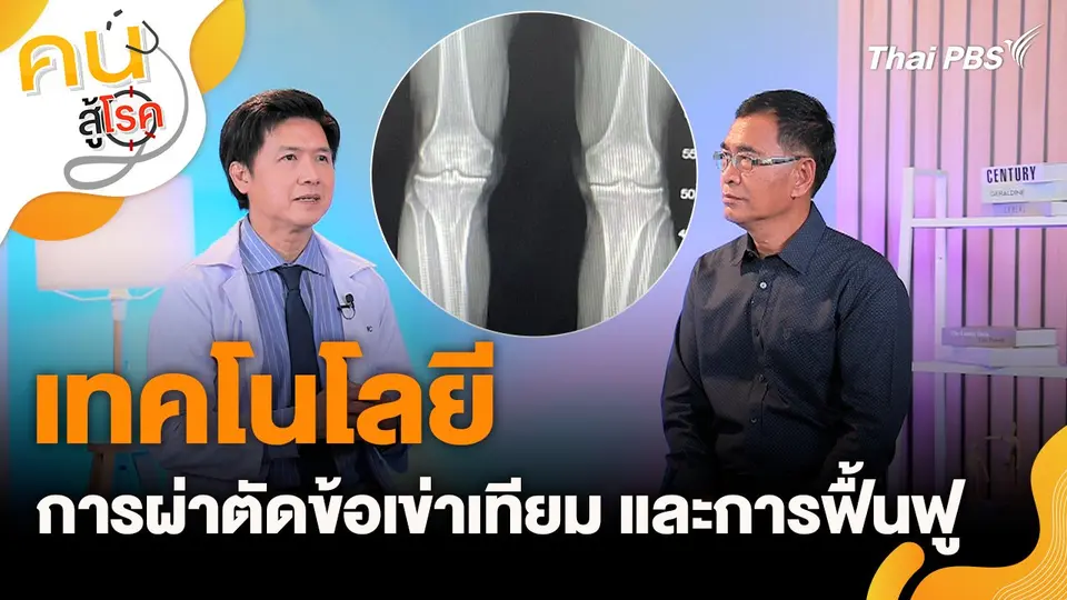 เทคโนโลยีการผ่าตัดข้อเข่าเทียม และการฟื้นฟู