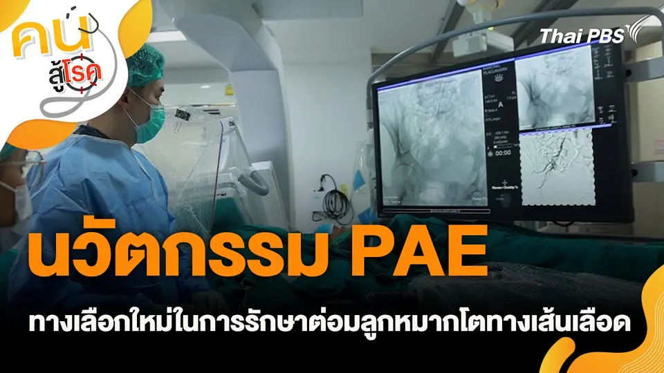 คนสู้โรค
