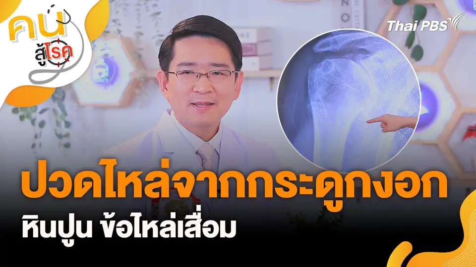 คนสู้โรค