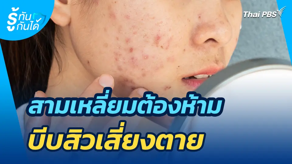 สามเหลี่ยมต้องห้าม บีบสิวเสี่ยงตาย