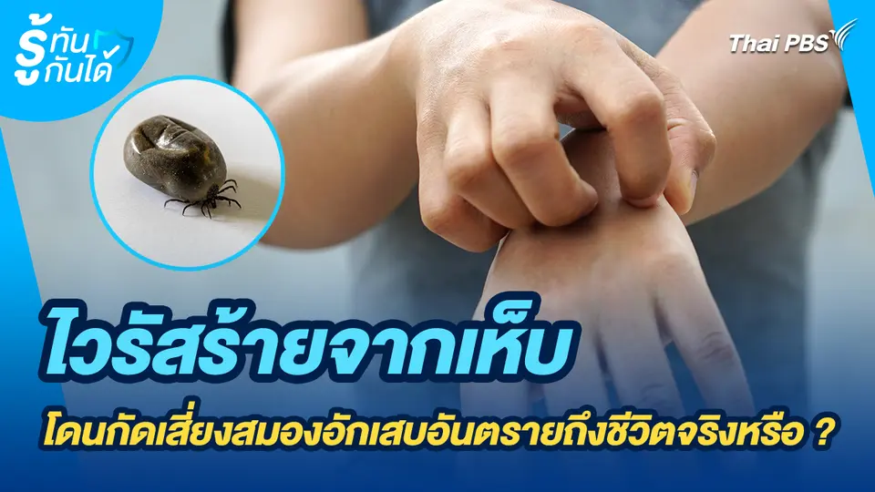 รู้ทันกันได้ : ไวรัสร้ายจากเห็บ โดนกัดเสี่ยงสมองอักเสบอันตรายถึงชีวิตจริงหรือ ?