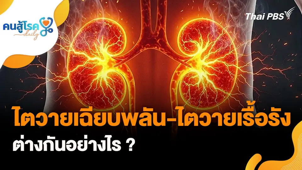 ไตวายเฉียบพลัน-ไตวายเรื้อรัง ต่างกันอย่างไร ?, ปากกาลดน้ำหนัก ปลอดภัยจริงหรือ ?
