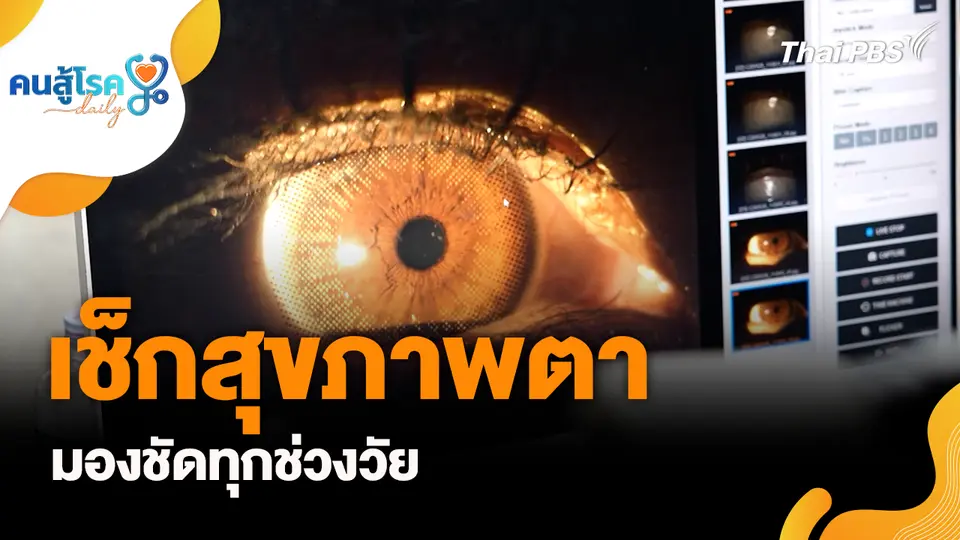 เช็กสุขภาพตา มองชัดทุกช่วงวัย