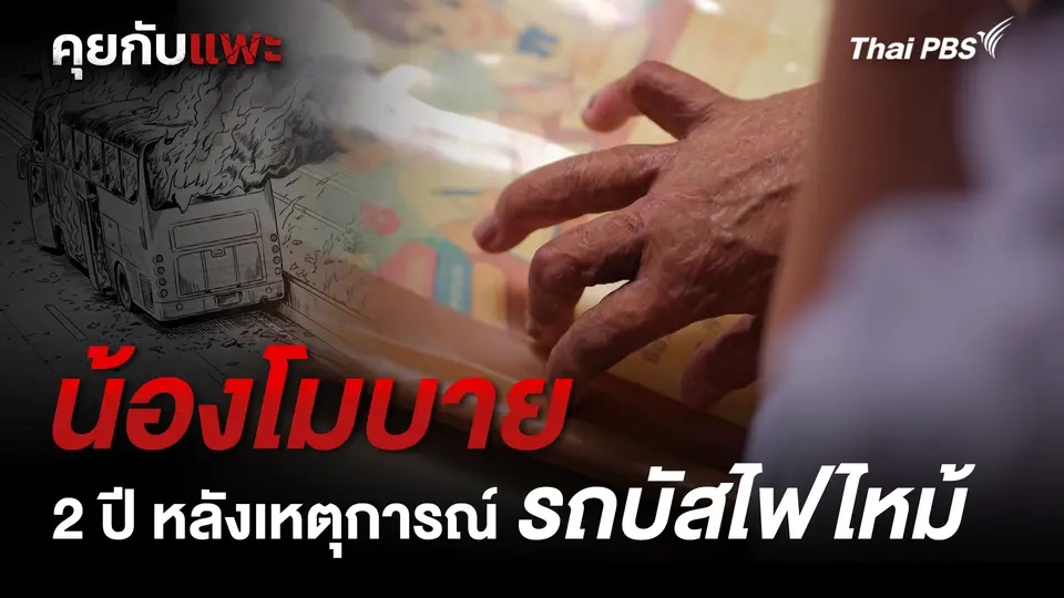2 ปี หลังเหตุการณ์ไฟไหม้รถบัส :  น้องโมบาย  | คุยกับแพะ