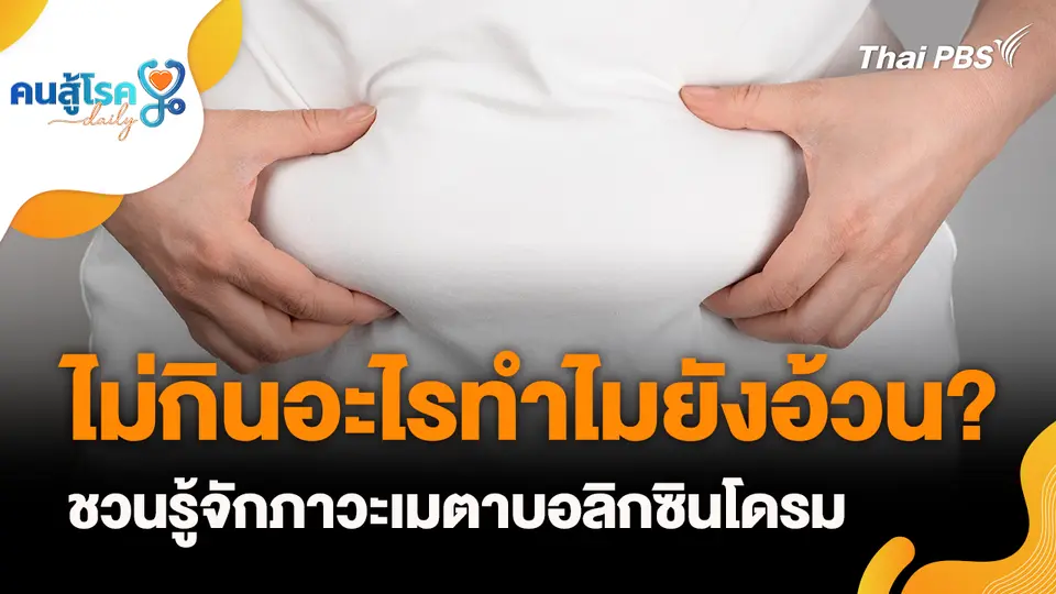 ชวนรู้จักภาวะเมตาบอลิกซินโดรม, "ไมเกรน" ไม่จำเป็นต้องปวดหัว แต่บ้านหมุนจริงหรือ?
