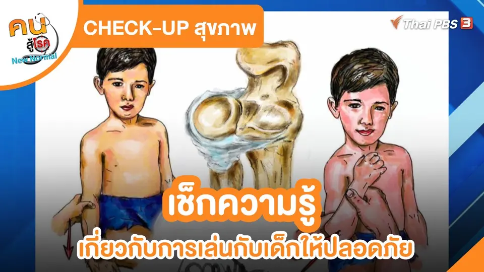 ​CHECK-UP สุขภาพ : เช็กข้อควรรู้เกี่ยวกับการเล่นกับเด็กให้ปลอดภัย