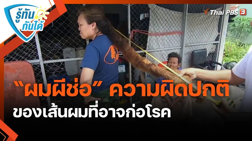 ​รู้ทันกันได้ : “ผมผีช่อ” ความผิดปกติของเส้นผมที่อาจก่อโรค