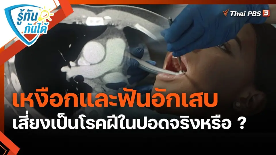 ​รู้ทันกันได้ : เหงือกและฟันอักเสบ เสี่ยงเป็นโรคฝีในปอดจริงหรือ ?
