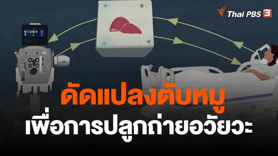 ดัดแปลงตับหมูเพื่อการปลูกถ่ายอวัยวะ