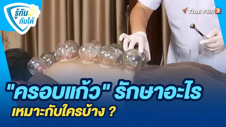 "ครอบแก้ว" รักษาอะไร เหมาะกับใครบ้าง ?