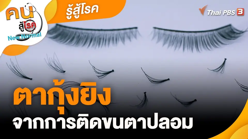 รู้สู้โรค : ตากุ้งยิง จากการติดขนตาปลอม