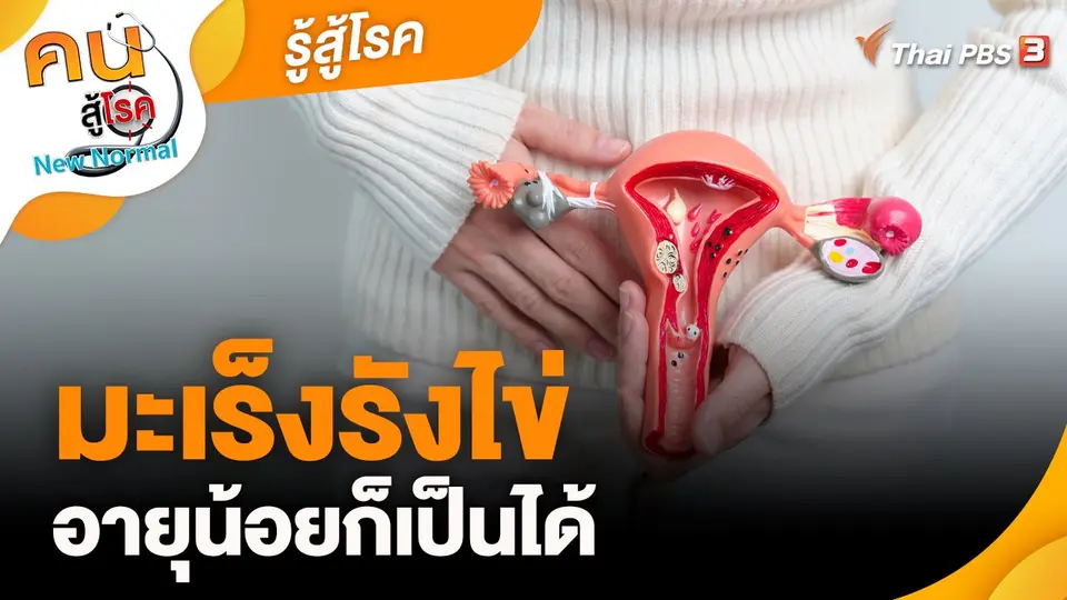 ​รู้สู้โรค : มะเร็งรังไข่อายุน้อยก็เป็นได้
