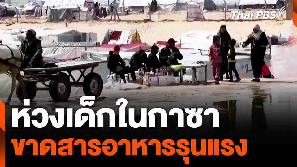"สหประชาชาติ" ห่วงเด็กในกาซาขาดสารอาหารรุนแรง