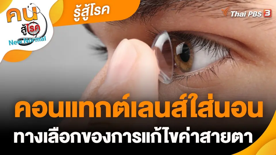​รู้สู้โรค : คอนแทกต์เลนส์ใส่นอน ทางเลือกของการแก้ไขค่าสายตา