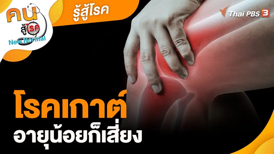 รู้สู้โรค : โรคเกาต์อายุน้อยก็เสี่ยง