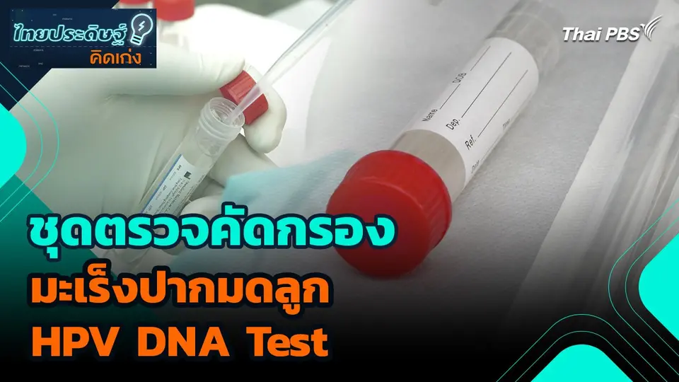 ไทยประดิษฐ์คิดเก่ง : ชุดตรวจคัดกรองมะเร็งปากมดลูก HPV DNA Test