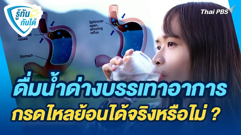 รู้ทันกันได้ : ดื่มน้ำด่างบรรเทาอาการกรดไหลย้อนได้จริงหรือไม่ ?