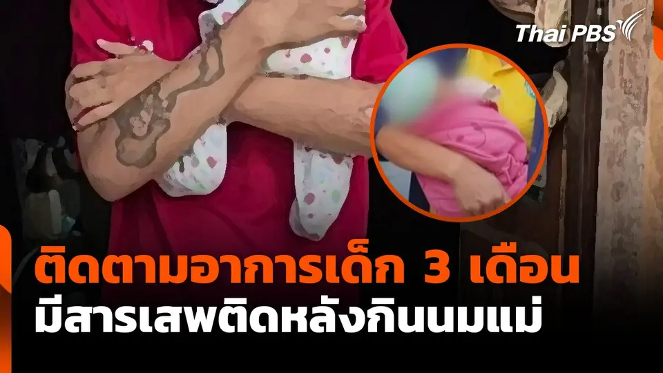 ติดตามอาการเด็ก 3 เดือนมีสารเสพติดหลังกินนมแม่