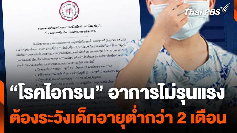 กรมควบคุมโรค ชี้ "ไอกรน" ไม่รุนแรง แต่ให้เฝ้าระวังเด็กต่ำกว่า 2 เดือน