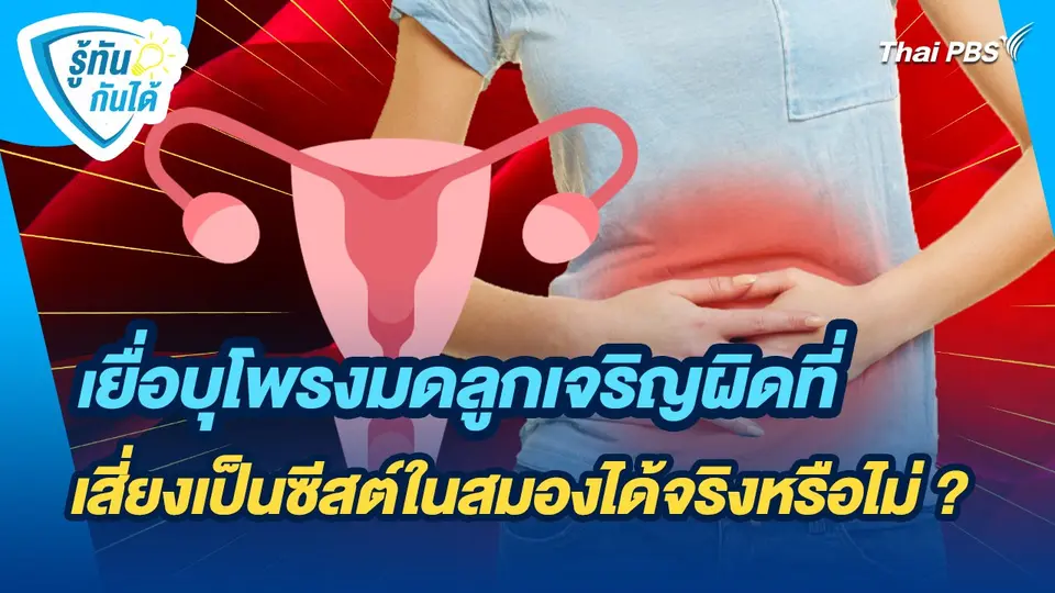 รู้ทันกันได้ : เยื่อบุโพรงมดลูกเจริญผิดที่ เสี่ยงเป็นซีสต์ในสมองได้จริงหรือไม่ ?