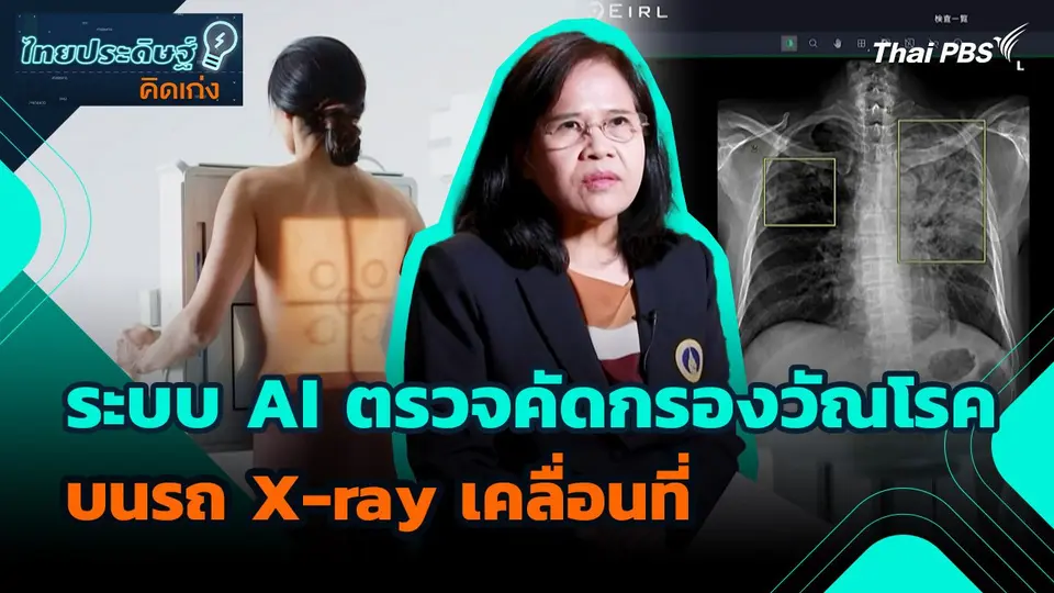 ไทยประดิษฐ์คิดเก่ง : ระบบ AI ตรวจคัดกรองวัณโรคบนรถ X-ray เคลื่อนที่