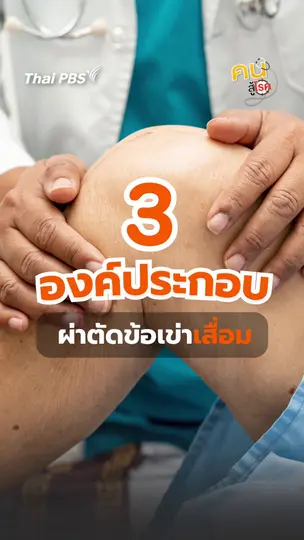 ​เข่าเสื่อมไม่ต้องผ่าตัดเสมอไป | #คนสู้โรค