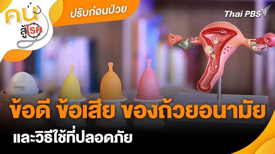 ปรับก่อนป่วย : ข้อดีข้อเสียของถ้วยอนามัย และวิธีใช้อย่างปลอดภัย