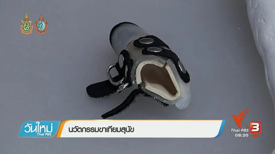 บอกเล่าข่าวดี : นวัตกรรมขาเทียมสุนัข