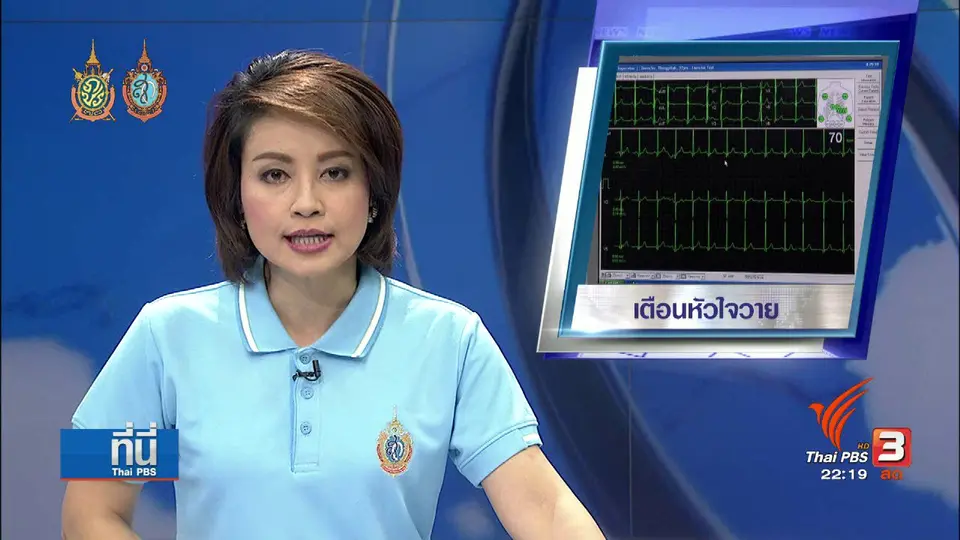 ที่นี่ Thai PBS : เตือนกลุ่มเสี่ยง "หัวใจวาย" ระวัง อาการลุ้น ตื่นเต้น