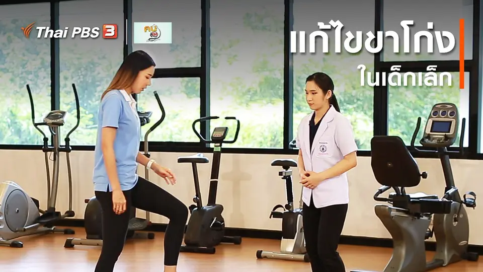 บำบัดง่าย ๆ ด้วยกายภาพ : แก้ไขขาโก่งในเด็กเล็ก